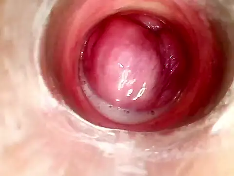endoscopio in u tero - vídeo de la modelo de cam karol_kane