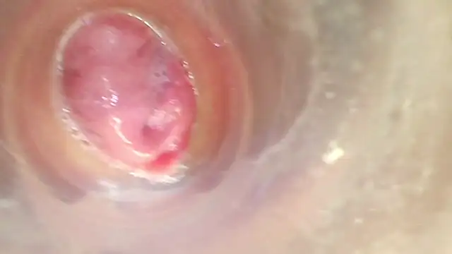 PLAY PUSY CUM ENDOSCOPIO
