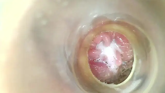 ENDOSCOPIO EN PUSSY  CUM