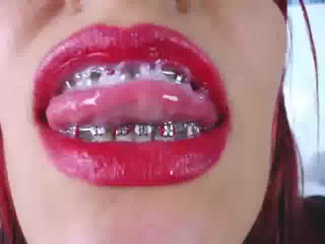 My braces with much saliva - video by naughty_flower18 cam model