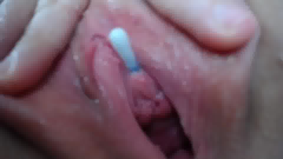 swab in my peehole - ক্যাম মডেল fisting_room-এর ভিডিও
